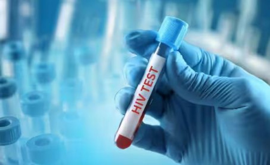 सिर्फ फिजिकल होने से ही नहीं. गलतियों से भी हो जाता है HIV AIDS